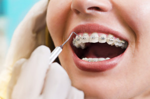 orthodontic treatment